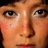 dark spot treatment — Dark Spot Treatments for Post-Acne Marks