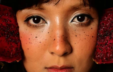 dark spot treatment — Dark Spot Treatments for Post-Acne Marks