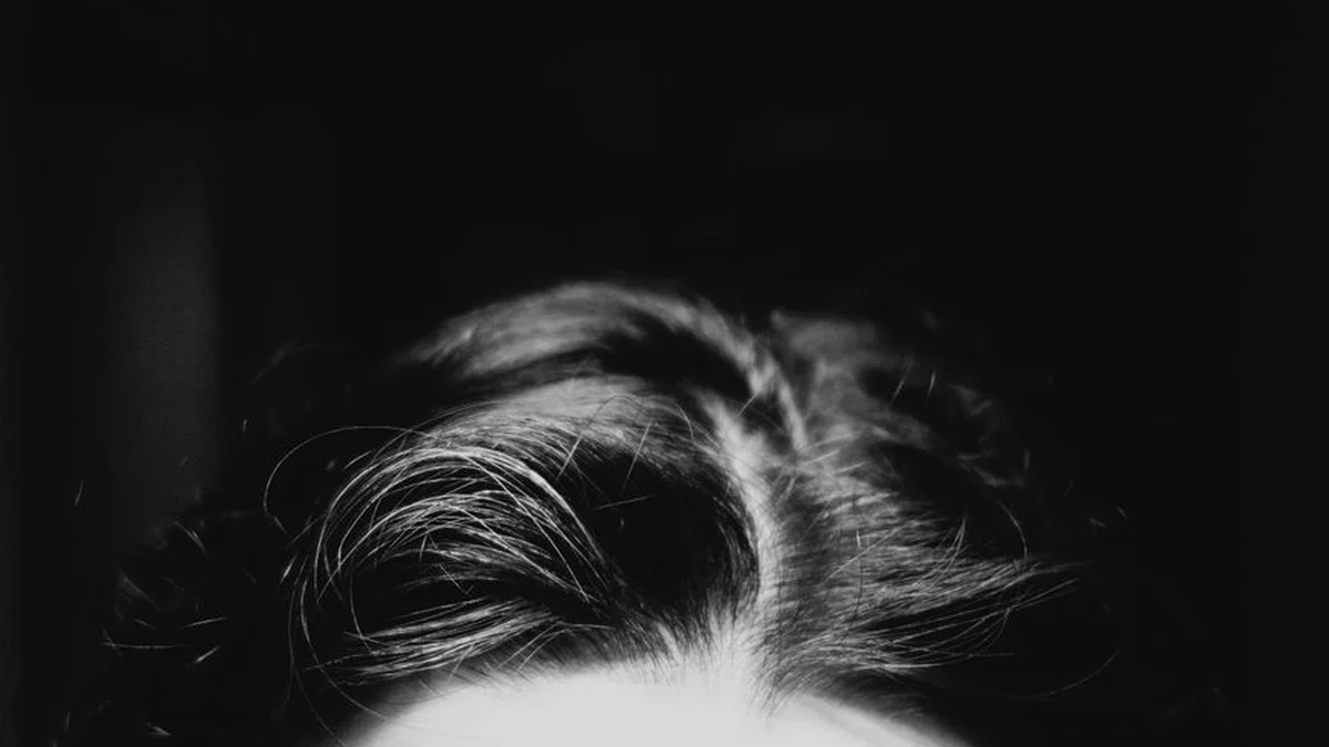 hair loss treatment for women in practice — step by step