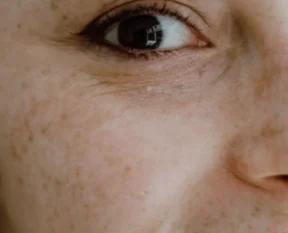 pore minimisers — What Can and Can't Change Pore Size